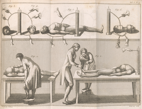 Aldini, Giovanni, 1762-1834. Essai theorique et experimental sur le galvanisme
